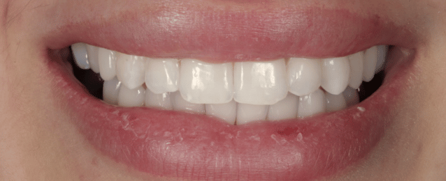 After -Arte Dental