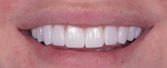 After -Arte Dental