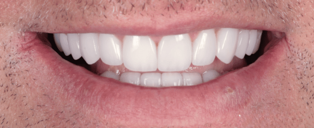 After - Arte Dental