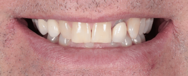 Before - Arte Dental