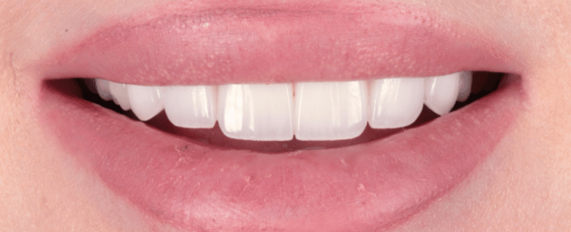 After - Arte Dental