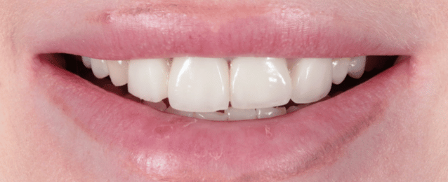 Before - Arte Dental