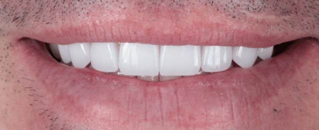 After - Arte Dental