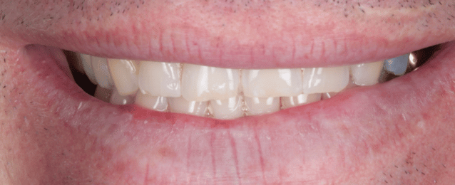 Before - Arte Dental