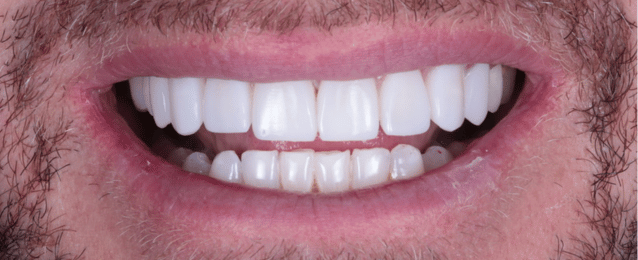 After - Arte Dental