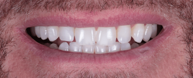Before - Arte Dental