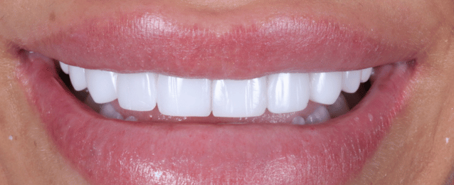 After - Arte Dental
