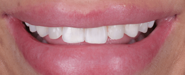 Before - Arte Dental