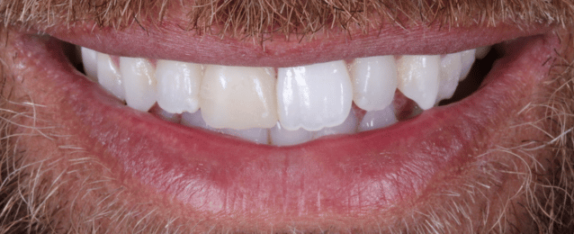 Before - Arte Dental