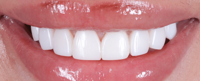 After - Arte Dental