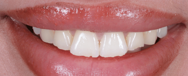 Before - Arte Dental
