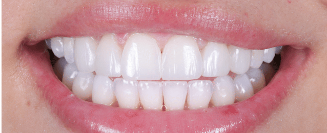 After - Arte Dental