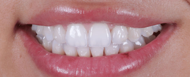 Before - Arte Dental