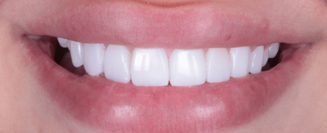 After - Arte Dental