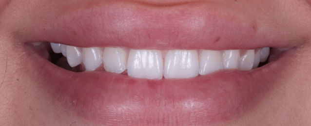 Before - Arte Dental