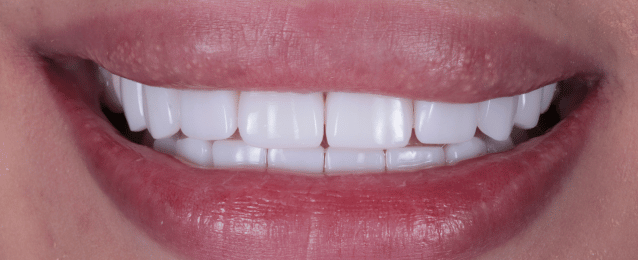 After - Arte Dental