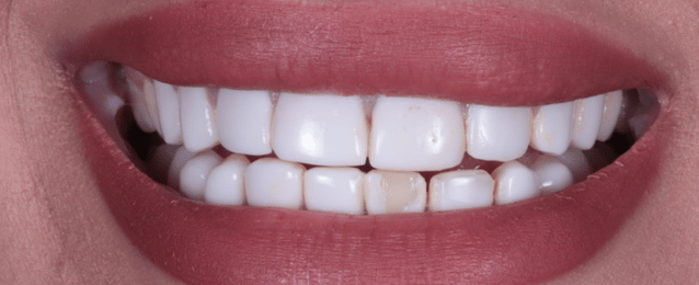Before - Arte Dental