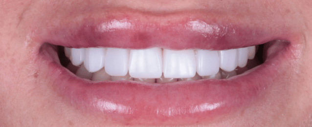 After - Arte Dental