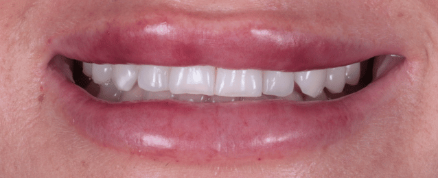 Before - Arte Dental