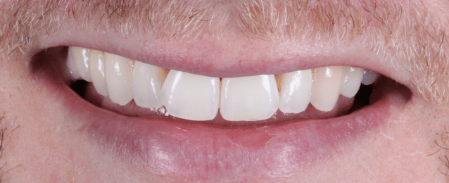 After - Arte Dental