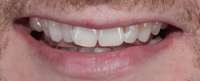 Before - Arte Dental