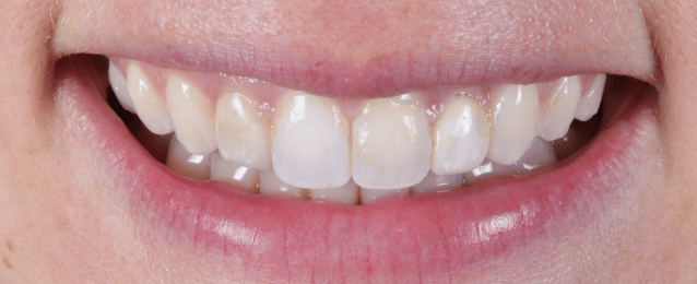 After - Arte Dental