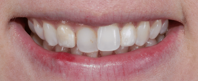Before - Arte Dental