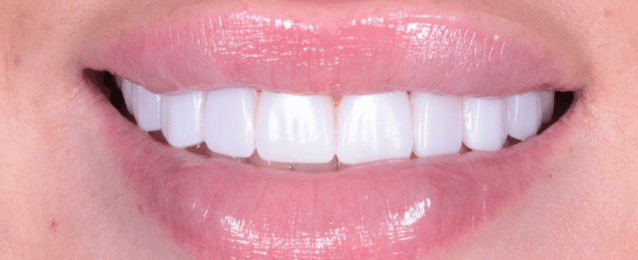 After - Arte Dental