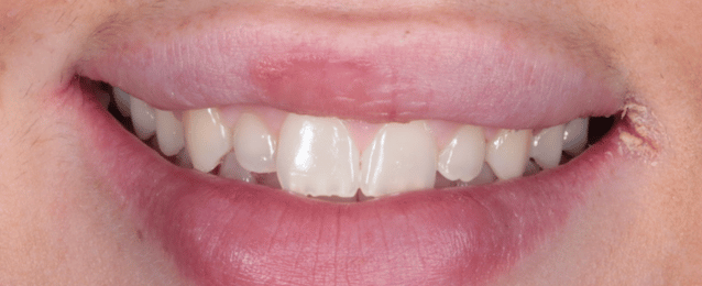 Before - Arte Dental