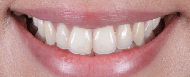 Before - Arte Dental