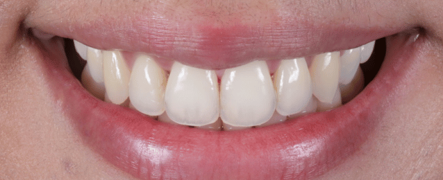 After - Arte Dental