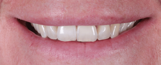 After - Arte Dental