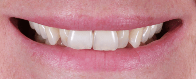 Before - Arte Dental