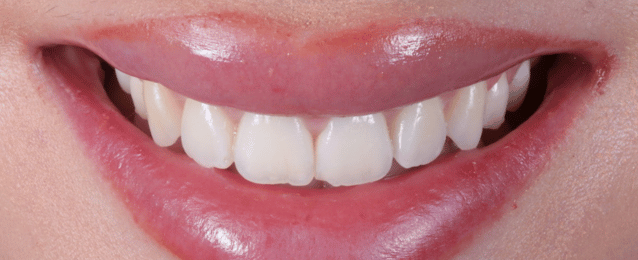 After - Arte Dental