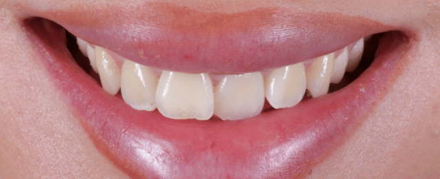 Before - Arte Dental