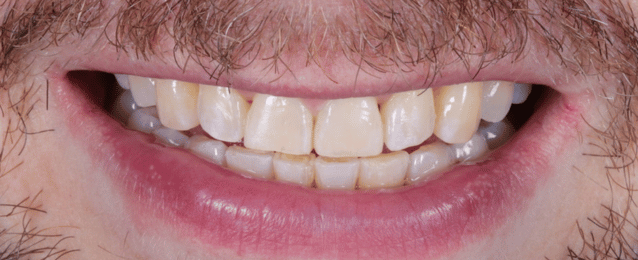 After - Arte Dental