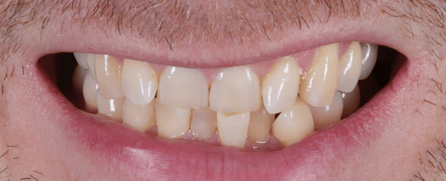Before - Arte Dental