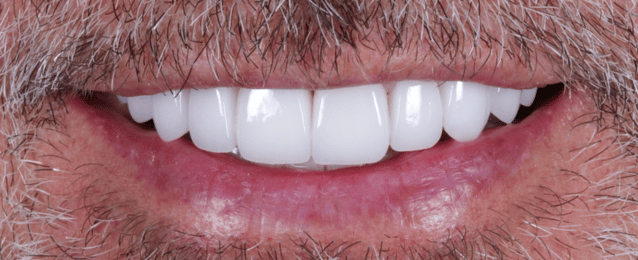 After - Arte Dental