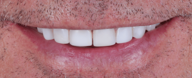 Before - Arte Dental