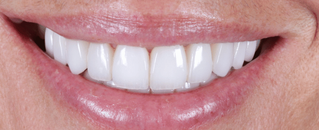 After - Arte Dental