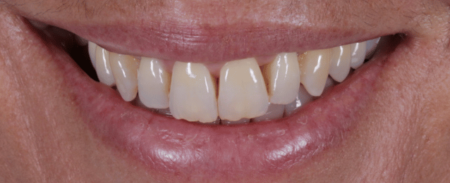 Before - Arte Dental