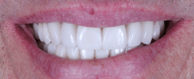 After - Arte Dental