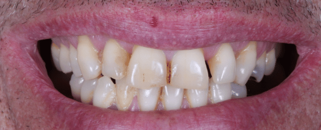 Before - Arte Dental