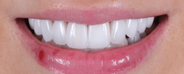 After - Arte Dental