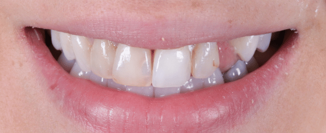Before - Arte Dental