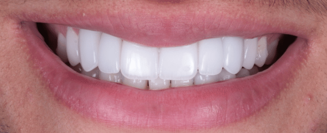 After - Arte Dental