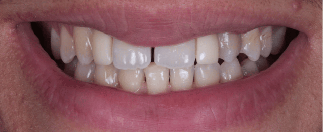 Before - Arte Dental