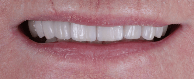 After - Arte Dental