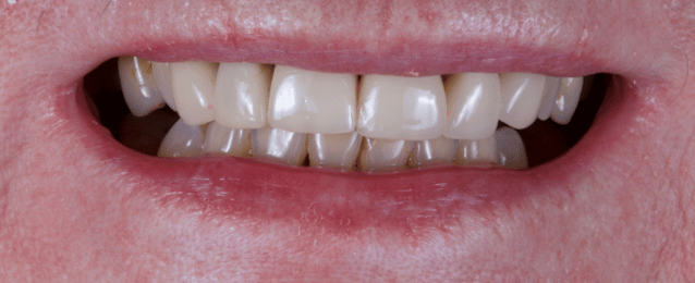 Before - Arte Dental