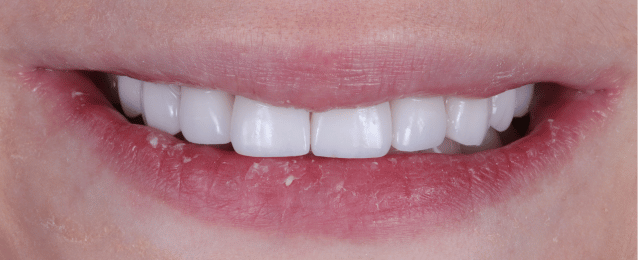 After - Arte Dental